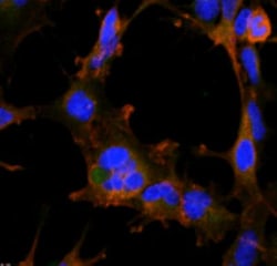 Hexanoyl-Lysine adduct Antibody (5D9), Novus Biologicals:Antibodies:Primary