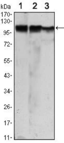 Hexokinase 2 Antibody (3D3), Novus Biologicals:Antibodies:Primary Antibodies