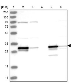 Histamine N-Methyltransferase/HNMT Antibody, Novus Biologicals 0.1mL; Unlabeled:Antibodies,