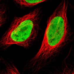 Histone Deacetylase 2/HDAC2 Antibody, Novus Biologicals 0.1mL; Unlabeled:Antibodies,