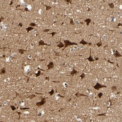 Histone Deacetylase 2/HDAC2 Antibody, Novus Biologicals 0.1mL; Unlabeled:Antibodies,