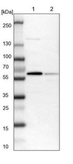 Histone Deacetylase 2/HDAC2 Antibody, Novus Biologicals 0.1mL; Unlabeled:Antibodies,