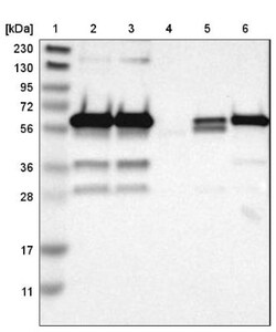 Histone Deacetylase 2/HDAC2 Antibody, Novus Biologicals 0.1mL; Unlabeled:Antibodies,