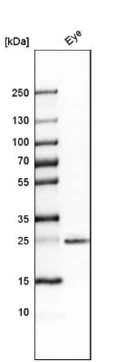 SIX6 Antibody, Novus Biologicals:Antibodies:Primary Antibodies