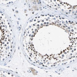 Host cell factor C2 Antibody, Novus Biologicals 0.1 mL | Buy Online | Novus Biologicals | Fisher Scientific