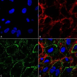 HSP70/HSPA1A Antibody (1H11), Novus Biologicals:Antibodies:Primary Antibodies