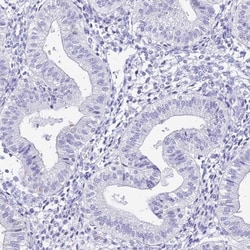 HspA1L Antibody, Novus Biologicals 0.1mL; Unlabeled:Antibodies, Polyclonal