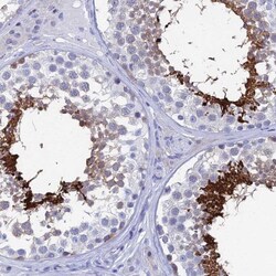 HspA1L Antibody, Novus Biologicals 0.1mL; Unlabeled:Antibodies, Polyclonal
