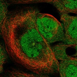 HspB11 Antibody, Novus Biologicals 0.1mL; Unlabeled:Antibodies, Polyclonal