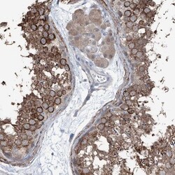 HspB11 Antibody, Novus Biologicals 0.1mL; Unlabeled:Antibodies, Polyclonal