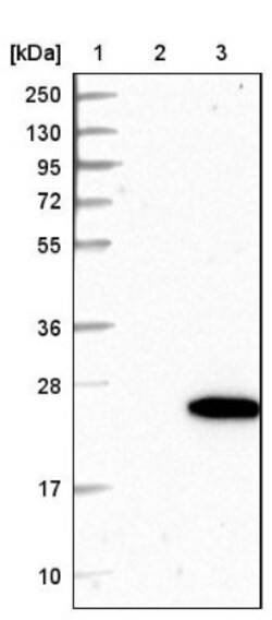 HspB7 Antibody, Novus Biologicals 0.1mL; Unlabeled:Antibodies, Polyclonal