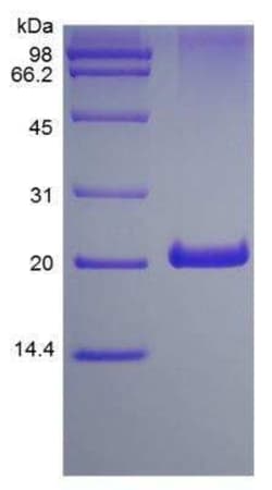 Novus Biologicals Recombinant Human 4-1BB/TNFRSF9/CD137 Protein 1 mg | Buy Online | Novus Biologicals&trade; | Fisher Scientific