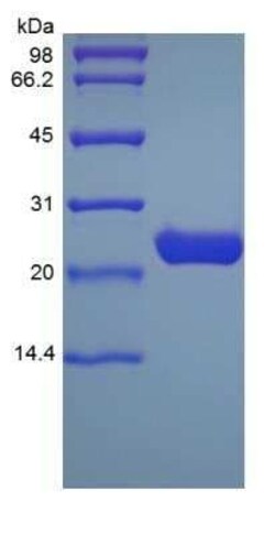 Novus Biologicals Recombinant Human Apolipoprotein A-I/ApoA1 Protein 500 &mu;g | Buy Online | Novus Biologicals&trade; | Fisher Scientific