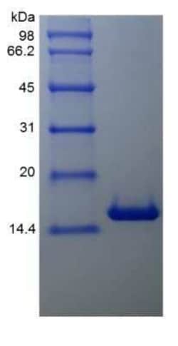Novus Biologicals Recombinant Human BCL-W/BCL2L2 Protein 1000 &mu;g | Buy Online | Novus Biologicals&trade; | Fisher Scientific