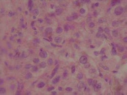 Novus Biologicals Human Breast Tissue Lysate (Adult Normal) 0,1 mg | Buy Online | Novus Biologicals&trade; | Fisher Scientific