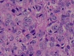 Novus Biologicals Human Breast Tissue Lysate (Adult Tumor) 0.1 mg | Buy Online | Novus Biologicals&trade; | Fisher Scientific