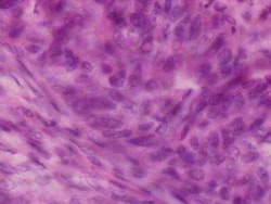 Novus Biologicals™ Human Breast Tissue Lysate (Adult Tumor)