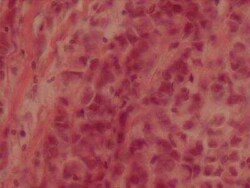 Novus Biologicals Human Breast Tissue Lysate (Adult Tumor) 0.1 mg | Buy Online | Novus Biologicals&trade; | Fisher Scientific