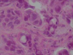 Novus Biologicals Human Breast Tissue Lysate (Adult Tumor) 0.1 mg | Buy Online | Novus Biologicals&trade; | Fisher Scientific