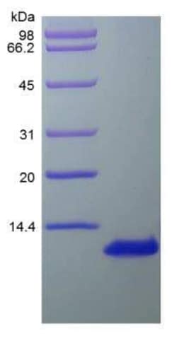 Novus Biologicals Recombinant Human CCL1/I-309/TCA-3 Protein 100 &mu;g | Buy Online | Novus Biologicals&trade; | Fisher Scientific