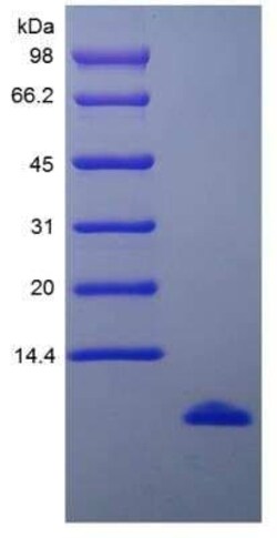 Novus Biologicals Recombinant Human CCL15/MIP-1 delta Protein 100 &mu;g | Buy Online | Novus Biologicals&trade; | Fisher Scientific