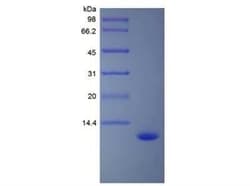 Novus Biologicals Recombinant Human CCL15/MIP-1 delta Protein 5 &mu;g | Buy Online | Novus Biologicals&trade; | Fisher Scientific