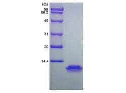 Novus Biologicals Recombinant Human CCL18/PARC Protein 500 &mu;g | Buy Online | Novus Biologicals&trade; | Fisher Scientific