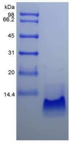 Novus Biologicals Recombinant Human CCL20/MIP-3 alpha Protein 1 mg | Buy Online | Novus Biologicals&trade; | Fisher Scientific