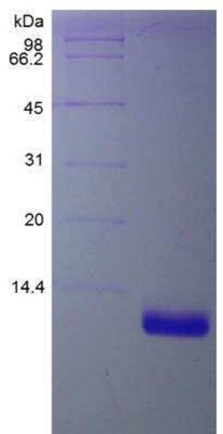 Novus Biologicals Recombinant Human CCL23/Ck beta 8-1/MIP3 Protein 1 mg | Buy Online | Novus Biologicals&trade; | Fisher Scientific
