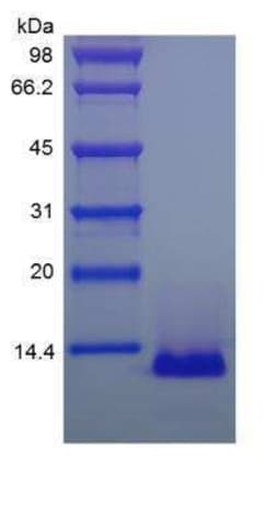Novus Biologicals Recombinant Human CCL26/Eotaxin-3 Protein 5 &mu;g | Buy Online | Novus Biologicals&trade; | Fisher Scientific