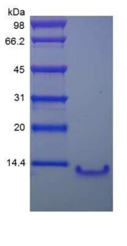 Novus Biologicals Recombinant Human CCL4L1/LAG-1 Protein 5 &mu;g | Buy Online | Novus Biologicals&trade; | Fisher Scientific
