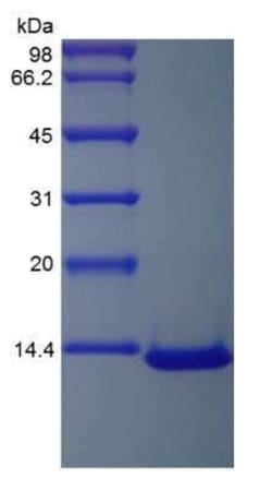 Novus Biologicals Recombinant Human CCL7/MCP-3/MARC Protein 10 &mu;g | Buy Online | Novus Biologicals&trade; | Fisher Scientific