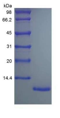 Novus Biologicals Recombinant Human CX3CL1/Fractalkine Protein 5 &mu;g | Buy Online | Novus Biologicals&trade; | Fisher Scientific