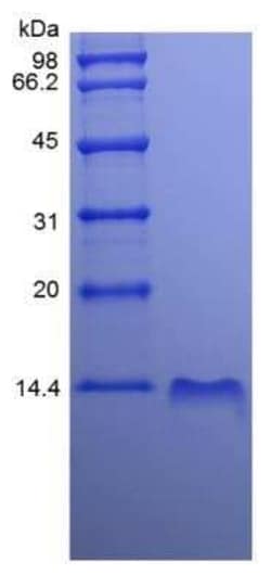 Novus Biologicals Recombinant Human CXCL10/IP-10/CRG-2 Protein 100 &mu;g | Buy Online | Novus Biologicals&trade; | Fisher Scientific