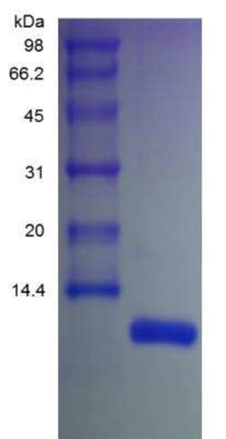 Novus Biologicals Recombinant Human CXCL12/SDF-1 beta Protein 10 &mu;g | Buy Online | Novus Biologicals&trade; | Fisher Scientific
