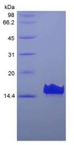 Novus Biologicals Recombinant Human CXCL17/VCC-1 Protein 1mg | Buy Online | Novus Biologicals&trade; | Fisher Scientific