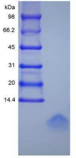 Novus Biologicals Recombinant Human Defensin beta 1 Protein 1 mg | Buy Online | Novus Biologicals&trade; | Fisher Scientific