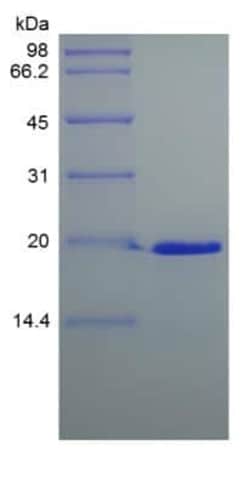 Novus Biologicals Recombinant Human Desert Hedgehog C23II Protein 100 &mu;g | Buy Online | Novus Biologicals&trade; | Fisher Scientific