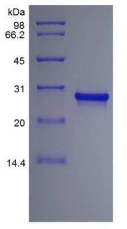 Novus Biologicals Recombinant Human FGF-13 Protein 500 &mu;g | Buy Online | Novus Biologicals&trade; | Fisher Scientific