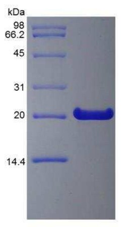 Novus Biologicals Recombinant Human FGF-21 Protein 5 &mu;g | Buy Online | Novus Biologicals&trade; | Fisher Scientific