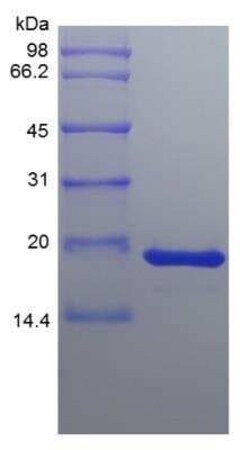 Novus Biologicals Recombinant Human FGF-4 Protein 1 mg | Buy Online | Novus Biologicals&trade; | Fisher Scientific