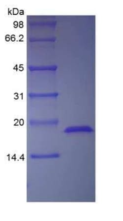 Novus Biologicals Recombinant Human FGF acidic/FGF1 Protein 1 mg | Buy Online | Novus Biologicals&trade; | Fisher Scientific