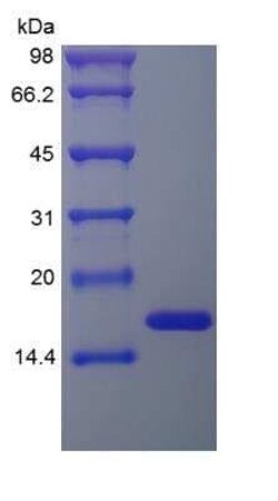 Novus Biologicals Recombinant Human FGF basic/FGF2/bFGF Protein 500 &mu;g | Buy Online | Novus Biologicals&trade; | Fisher Scientific