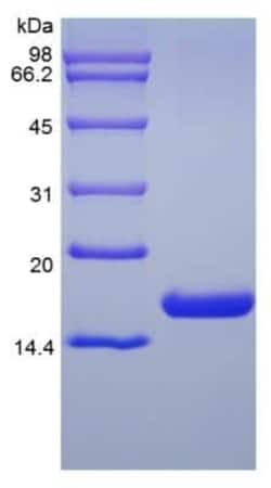Novus Biologicals Recombinant Human Flt-3 Ligand/FLT3L Protein 100 &mu;g | Buy Online | Novus Biologicals&trade; | Fisher Scientific