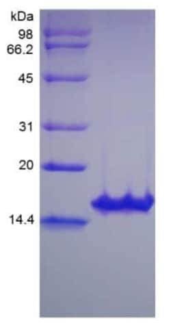 Novus Biologicals Recombinant Human GDNF Protein 10 &mu;g | Buy Online | Novus Biologicals&trade; | Fisher Scientific