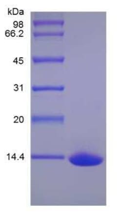 Novus Biologicals Recombinant Human GITR Ligand/TNFSF18 Protein 1 mg | Buy Online | Novus Biologicals&trade; | Fisher Scientific