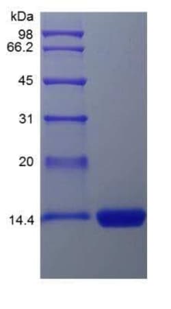 Novus Biologicals Recombinant Human GM-CSF Protein 1 mg | Buy Online | Novus Biologicals&trade; | Fisher Scientific