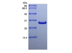 Novus Biologicals Recombinant Human Galectin-3 Protein 100 &mu;g | Buy Online | Novus Biologicals&trade; | Fisher Scientific