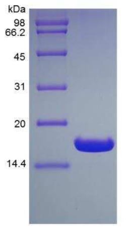Novus Biologicals Recombinant Human HR6B/UBE2B His (N-Term) Protein 10 &mu;g | Buy Online | Novus Biologicals&trade; | Fisher Scientific