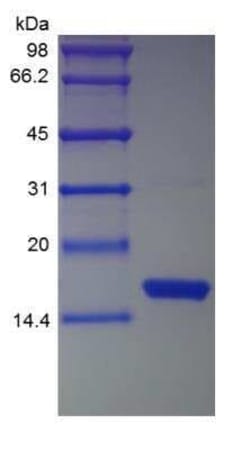 Novus Biologicals™ Recombinant Human IFN-gamma Protein